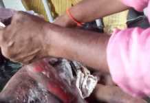 सुगौली में बैलून गैस सिलेंडर ब्लास्ट होने से दो दर्जन लोग हुए घायल