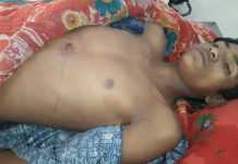 अपराधियों ने समस्तीपुर में युवक की गोली मार की हत्या