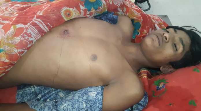 अपराधियों ने समस्तीपुर में युवक की गोली मार की हत्या