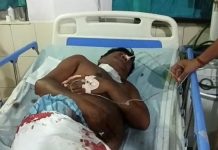 कांटी में राजद के 2 नेताओं व बाढ़ में भाजपा नेता को मारी गोली मुजफ्फरपुर के कांटी थाना इलाके में फायरिंग में जख्मी राजद नेता