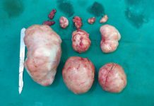 बच्चेदानी के ऑपरेशन के 6 महीने बाद मरीज का प्राकृतिक गर्भाधान है संभव